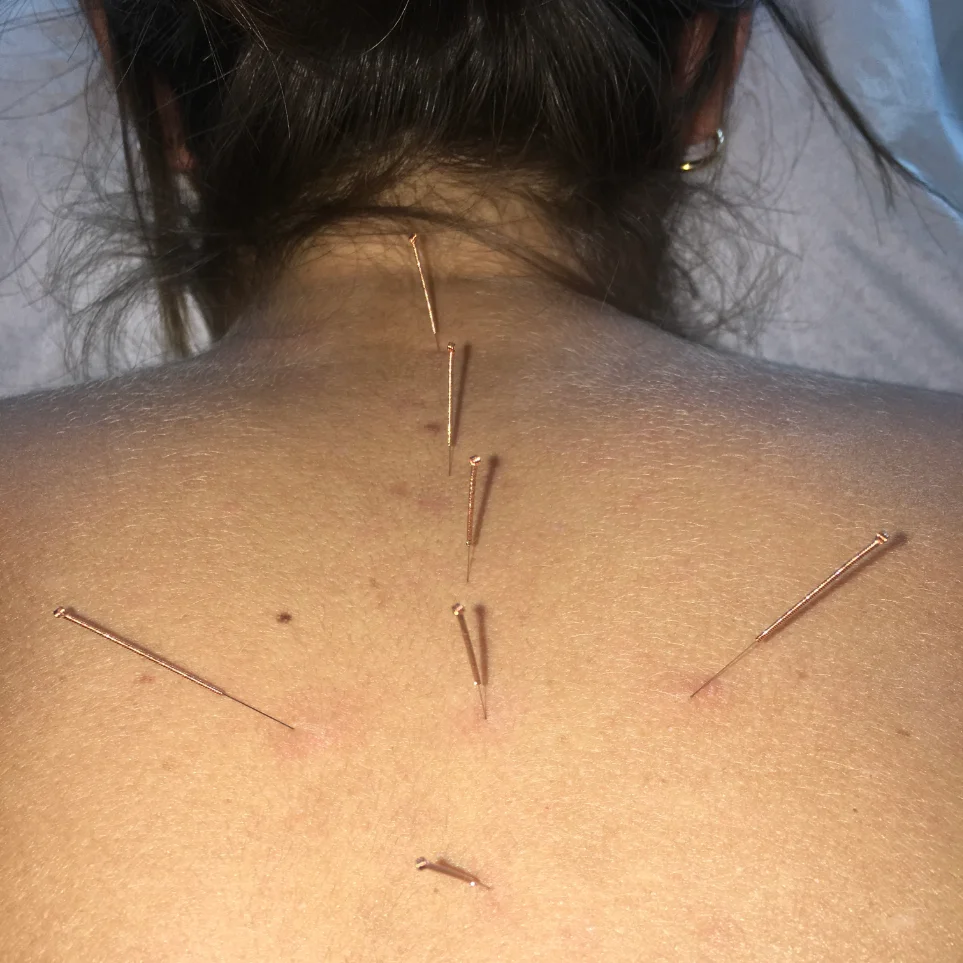 Osteopathy