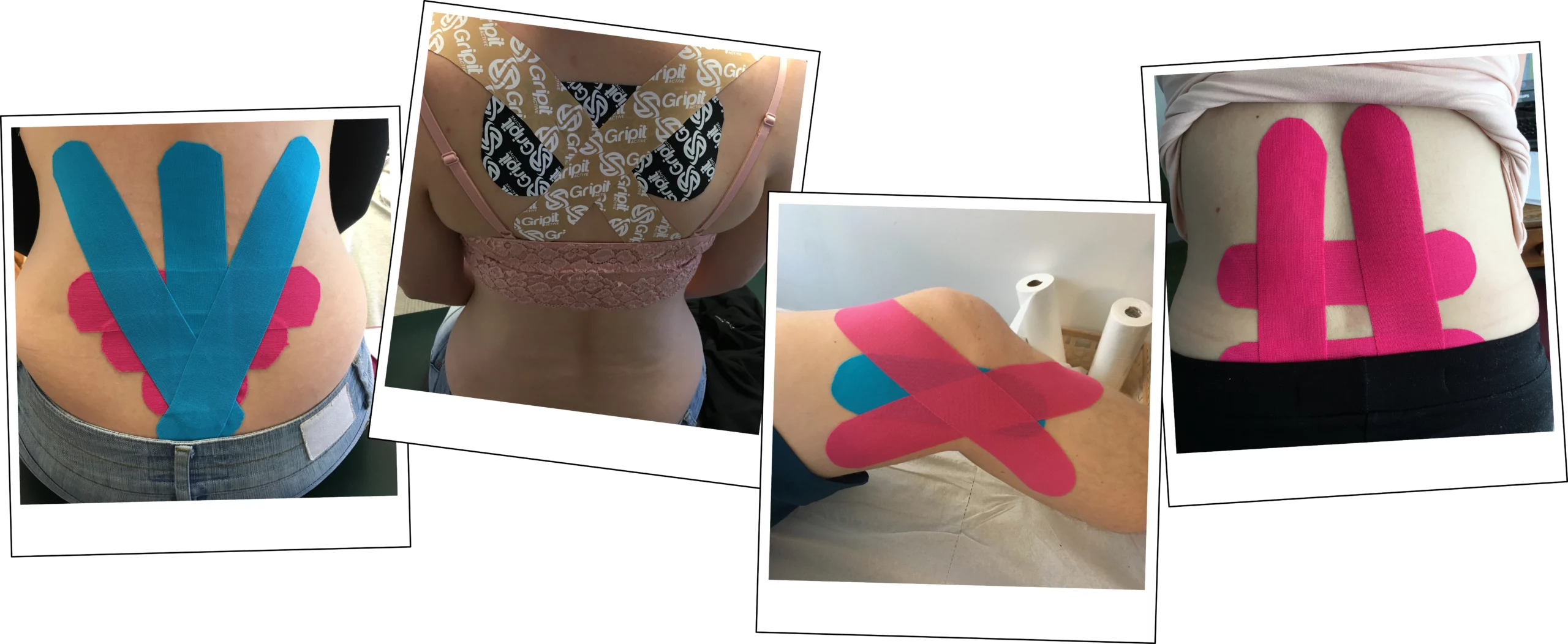 images of kinesiology tape applications to patients